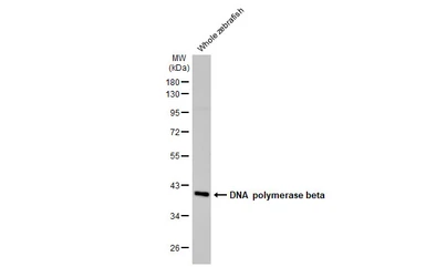 Anti-DNA polymerase beta antibody [HL1525] used in Western Blot (WB). GTX636999