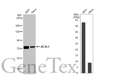 Anti-ACSL1 antibody [HL1530] used in Western Blot (WB). GTX637003