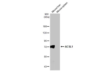 Anti-ACSL1 antibody [HL1530] used in Western Blot (WB). GTX637003