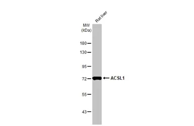 Anti-ACSL1 antibody [HL1530] used in Western Blot (WB). GTX637003