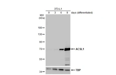 Anti-ACSL1 antibody [HL1530] used in Western Blot (WB). GTX637003