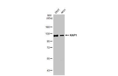 Anti-KAP1 antibody [HL1536] used in Western Blot (WB). GTX637010