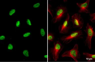 Anti-KAP1 antibody [HL1536] used in Immunocytochemistry/ Immunofluorescence (ICC/IF). GTX637010