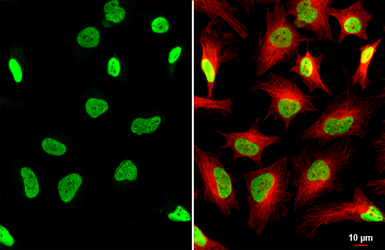 Anti-KAP1 antibody [HL1539] used in Immunocytochemistry/ Immunofluorescence (ICC/IF). GTX637013