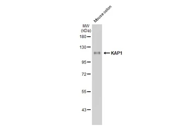 Anti-KAP1 antibody [HL1539] used in Western Blot (WB). GTX637013