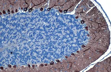 Anti-IP3 Receptor I antibody [HL1541] used in IHC (Paraffin sections) (IHC-P). GTX637015