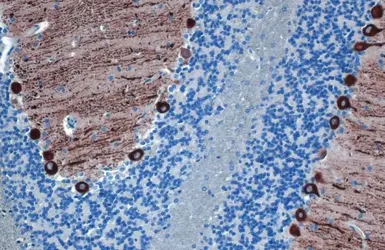 Anti-IP3 Receptor I antibody [HL1541] used in IHC (Paraffin sections) (IHC-P). GTX637015