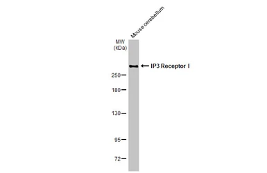 Anti-IP3 Receptor I antibody [HL1541] used in Western Blot (WB). GTX637015
