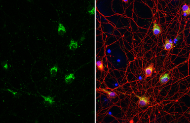 Anti-IP3 Receptor I antibody [HL1541] used in Immunocytochemistry/ Immunofluorescence (ICC/IF). GTX637015
