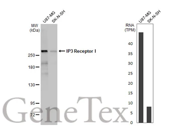 Anti-IP3 Receptor I antibody [HL1541] used in Western Blot (WB). GTX637015
