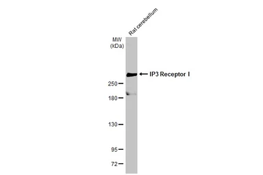 Anti-IP3 Receptor I antibody [HL1541] used in Western Blot (WB). GTX637015