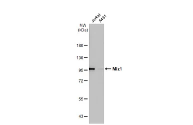 Anti-Miz1 antibody [HL1548] used in Western Blot (WB). GTX637023