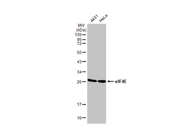Anti-eIF4E antibody [HL1553] used in Western Blot (WB). GTX637028