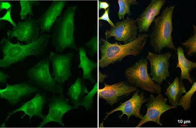 Anti-eIF4E antibody [HL1553] used in Immunocytochemistry/ Immunofluorescence (ICC/IF). GTX637028