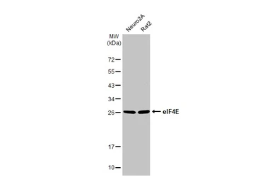 Anti-eIF4E antibody [HL1553] used in Western Blot (WB). GTX637028