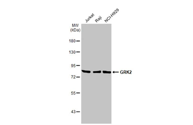 Anti-GRK2 antibody [HL1562] used in Western Blot (WB). GTX637038
