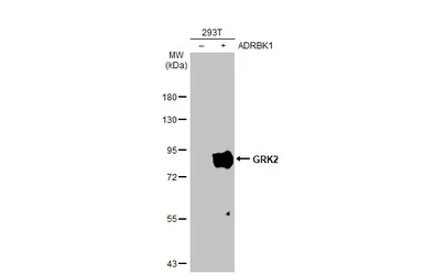 Anti-GRK2 antibody [HL1562] used in Western Blot (WB). GTX637038