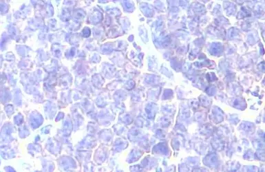 Anti-GRK2 antibody [HL1562] used in IHC (Paraffin sections) (IHC-P). GTX637038
