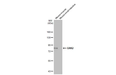 Anti-GRK2 antibody [HL1562] used in Western Blot (WB). GTX637038