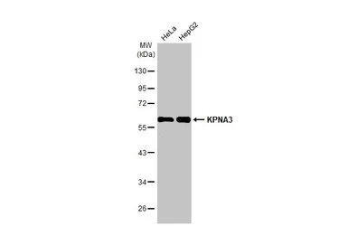 Anti-KPNA3 antibody [HL1573] used in Western Blot (WB). GTX637048