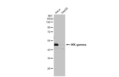 Anti-IKK gamma antibody [HL1577] used in Western Blot (WB). GTX637052