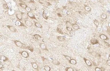 Anti-Hsp70 antibody [HL1580] used in IHC (Paraffin sections) (IHC-P). GTX637059