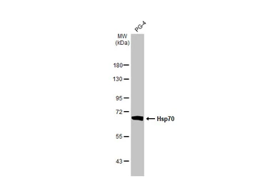 Anti-Hsp70 antibody [HL1581] used in Western Blot (WB). GTX637060