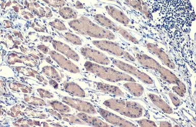 Anti-Hsp70 antibody [HL1581] used in IHC (Paraffin sections) (IHC-P). GTX637060