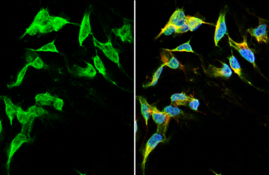 Anti-Dopamine Receptor D2 antibody [HL1584] used in Immunocytochemistry/ Immunofluorescence (ICC/IF). GTX637063