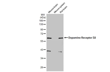 Anti-Dopamine Receptor D2 antibody [HL1584] used in Western Blot (WB). GTX637063