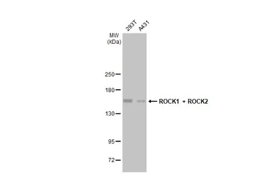 Anti-ROCK1 + ROCK2 antibody [HL1632] used in Western Blot (WB). GTX637125