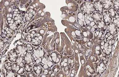 Anti-ROCK1 + ROCK2 antibody [HL1632] used in IHC (Paraffin sections) (IHC-P). GTX637125
