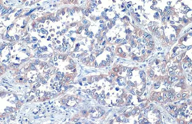 Anti-ROCK1 + ROCK2 antibody [HL1632] used in IHC (Paraffin sections) (IHC-P). GTX637125
