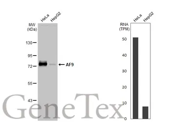 Anti-AF9 antibody [HL1644] used in Western Blot (WB). GTX637225