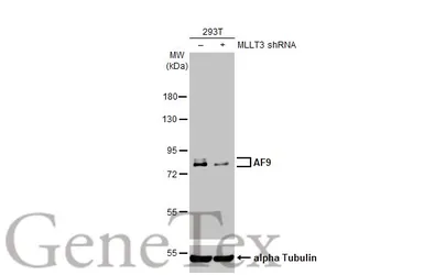 Anti-AF9 antibody [HL1644] used in Western Blot (WB). GTX637225