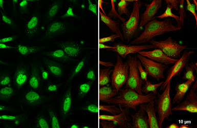 Anti-AF9 antibody [HL1644] used in Immunocytochemistry/ Immunofluorescence (ICC/IF). GTX637225