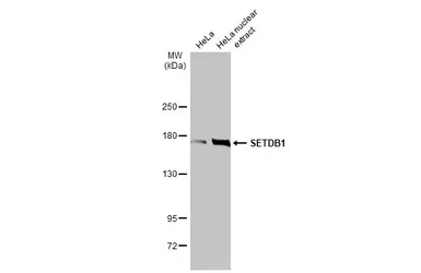 Anti-SETDB1 antibody [HL1645] used in Western Blot (WB). GTX637226