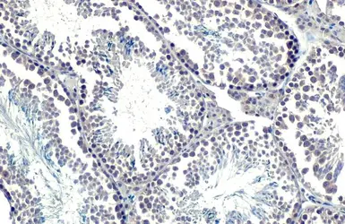 Anti-SETDB1 antibody [HL1645] used in IHC (Paraffin sections) (IHC-P). GTX637226