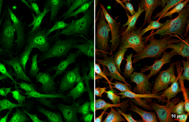 Anti-SETDB1 antibody [HL1645] used in Immunocytochemistry/ Immunofluorescence (ICC/IF). GTX637226