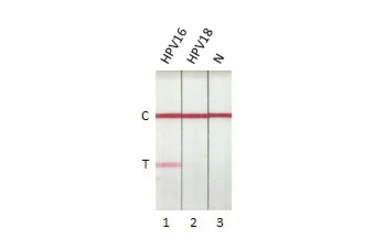 Anti-Human Papillomavirus type 16 E7 antibody [HL1647] used in Lateral Flow (Lateral Flow). GTX637228
