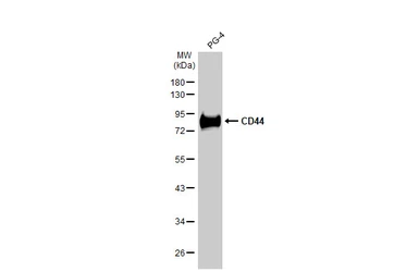 Anti-CD44 antibody [HL1650] used in Western Blot (WB). GTX637231