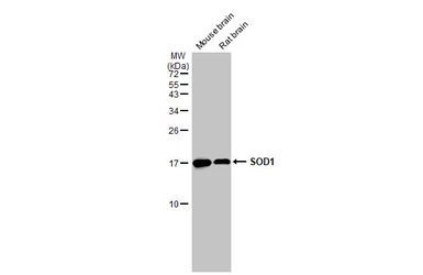 Anti-SOD1 antibody [HL1652] used in Western Blot (WB). GTX637250