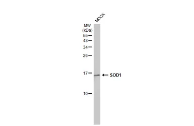 Anti-SOD1 antibody [HL1652] used in Western Blot (WB). GTX637250