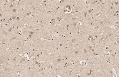 Anti-SOD1 antibody [HL1652] used in IHC (Paraffin sections) (IHC-P). GTX637250