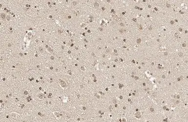 Anti-SOD1 antibody [HL1652] used in IHC (Paraffin sections) (IHC-P). GTX637250