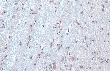 Anti-SOD1 antibody [HL1652] used in IHC (Paraffin sections) (IHC-P). GTX637250