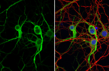 Anti-MAP2 antibody [HL1656] used in Immunocytochemistry/ Immunofluorescence (ICC/IF). GTX637254