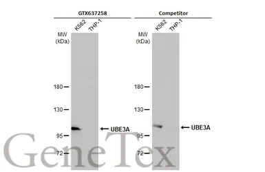 Anti-UBE3A antibody [HL1660] used in Western Blot (WB). GTX637258