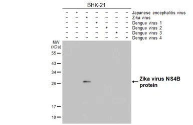 Anti-Zika virus NS4B protein antibody [HL1663] used in Western Blot (WB). GTX637261