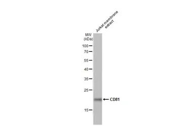 Anti-CD81 antibody [HL1666] used in Western Blot (WB). GTX637264